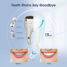 Load image into Gallery viewer, MiroPure Teeth Whitening System - BrillianceWhitening LLC